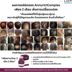 Alosol Thailand review 24