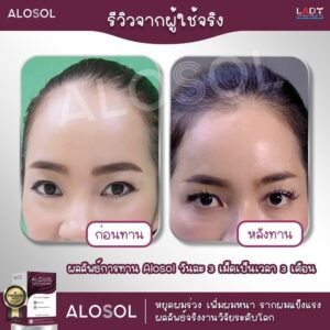 Alosol Thailand review 7