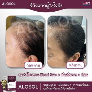 Alosol Thailand review 2